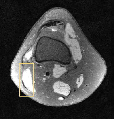 mri.png